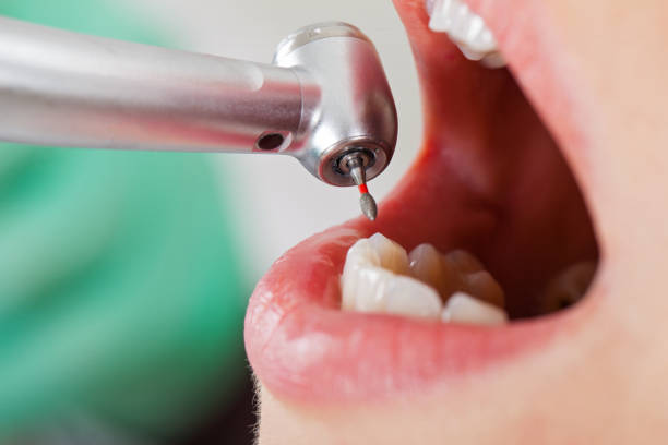 Best Emergency Treatment for Oral Infections in Progress, PA